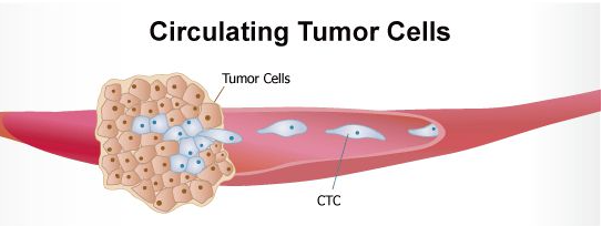 腫瘤患者外周血循環(huán)癌細(xì)胞檢測技術(shù)進(jìn)展