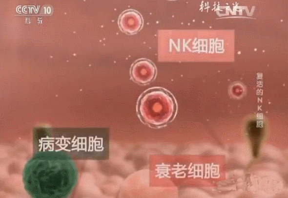 復(fù)活的NK細(xì)胞，讓她擺脫了亞健康！