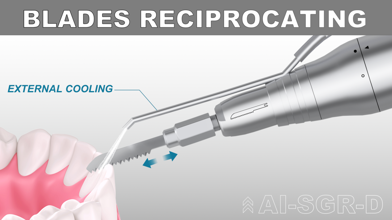 AI Focus On Dental Handpieces