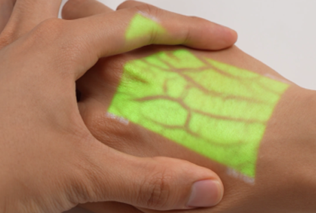 Vein Finder Magic! 🔥 Watch How FOINOE Lights Up Veins Instantly Vein Finder Magic! 🔥 Watch How FOINOE Lights Up Veins Instantly