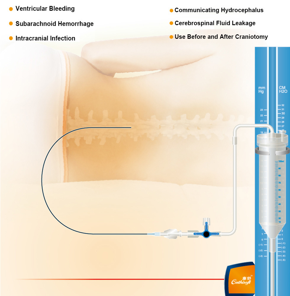 Continuous lumbar vertebra drainage system