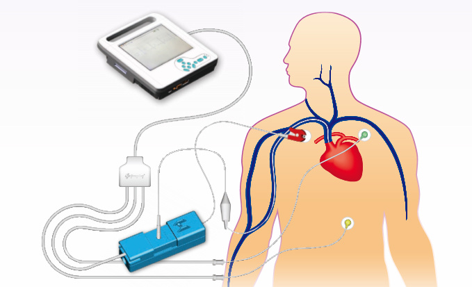 ECG Doppler ultrasound integrated machine
