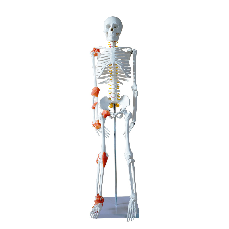 YA/L012D 人体骨骼附韧带模型85CM