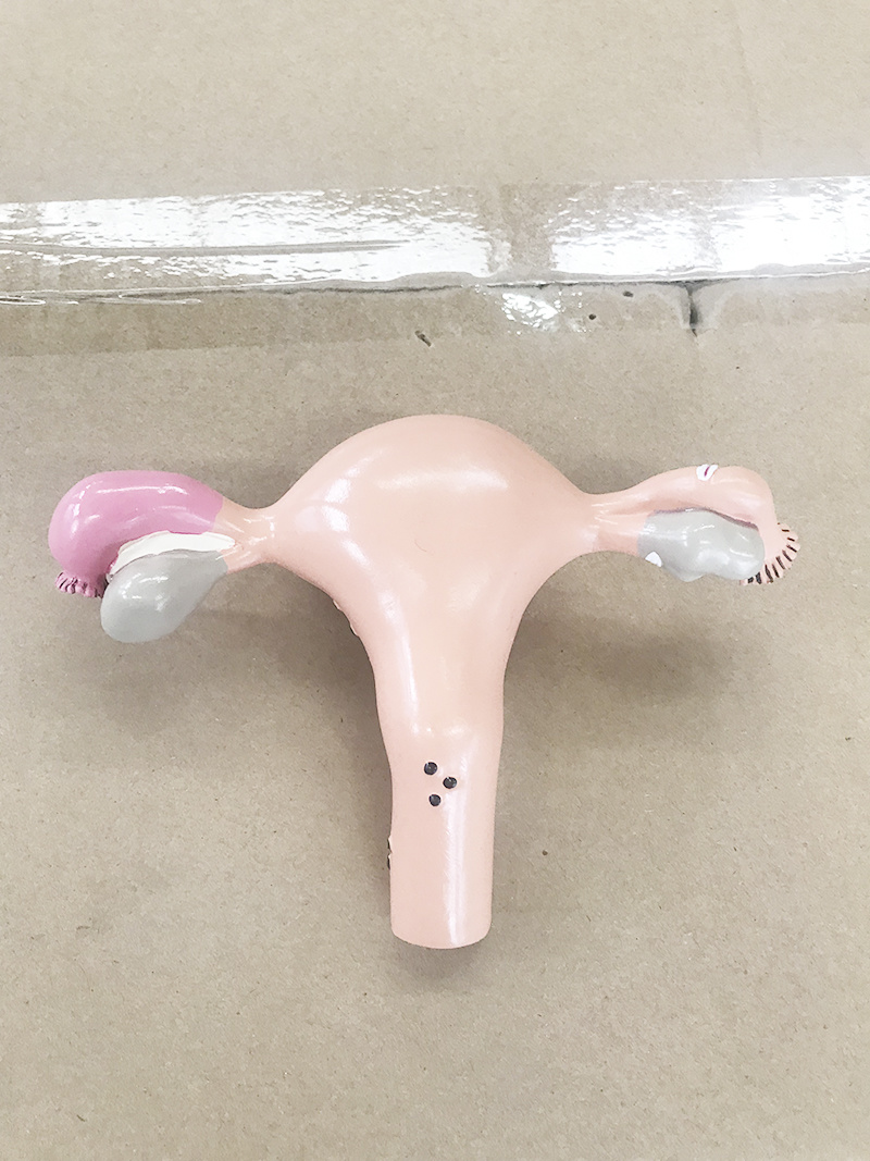 Mini uterine pathological model