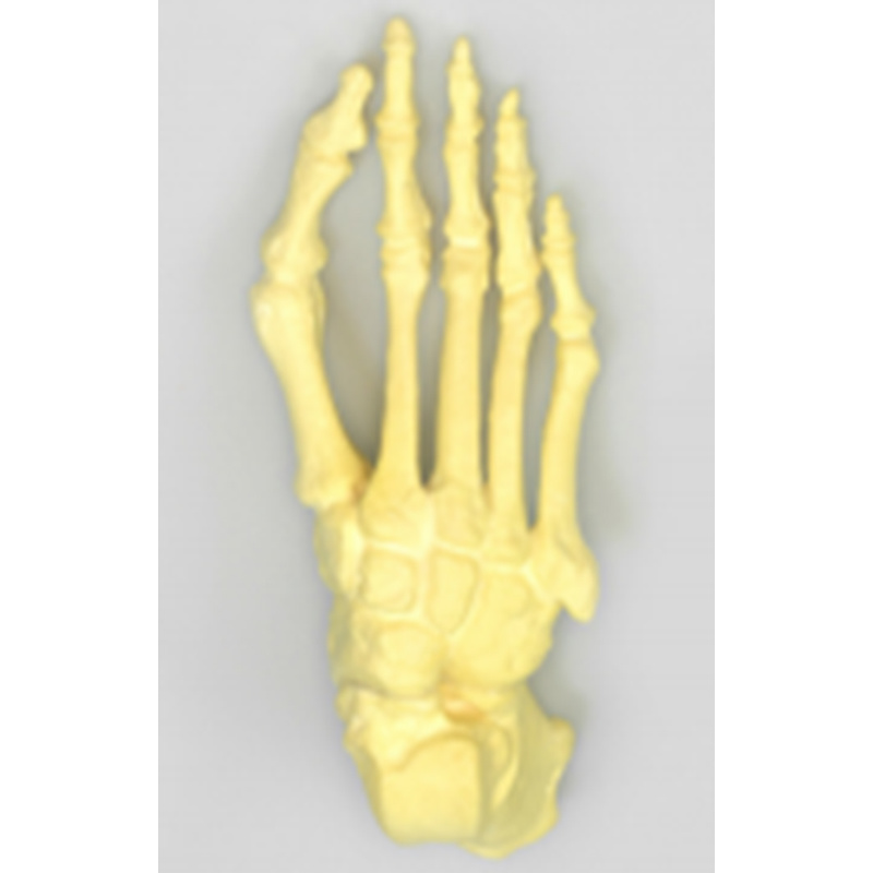 Foot Hallux Valgus Practice Model