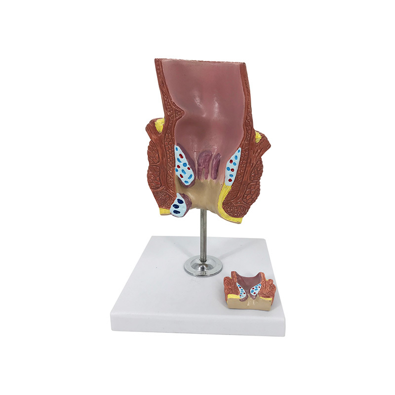 YA/D015C Hemorrhoid Anatomy Model