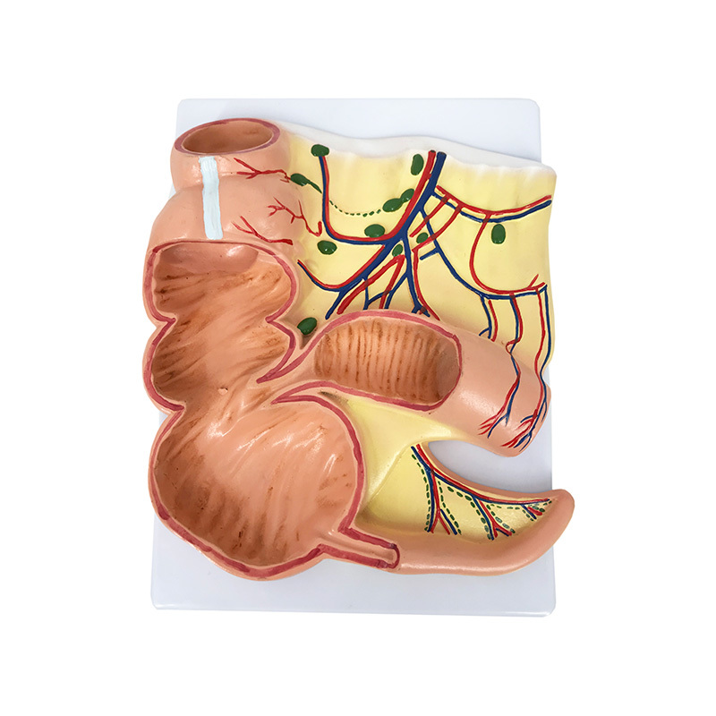 YA/D014 Caecum and Appendix