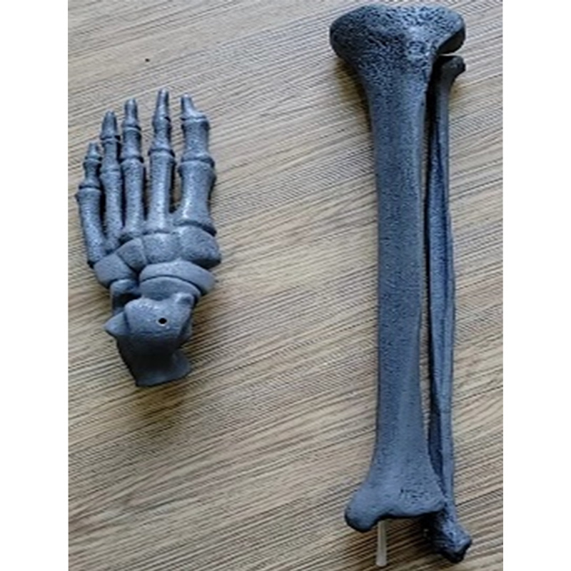 X-Ray Imaging of Tibia, Fibula and Foot Bone
