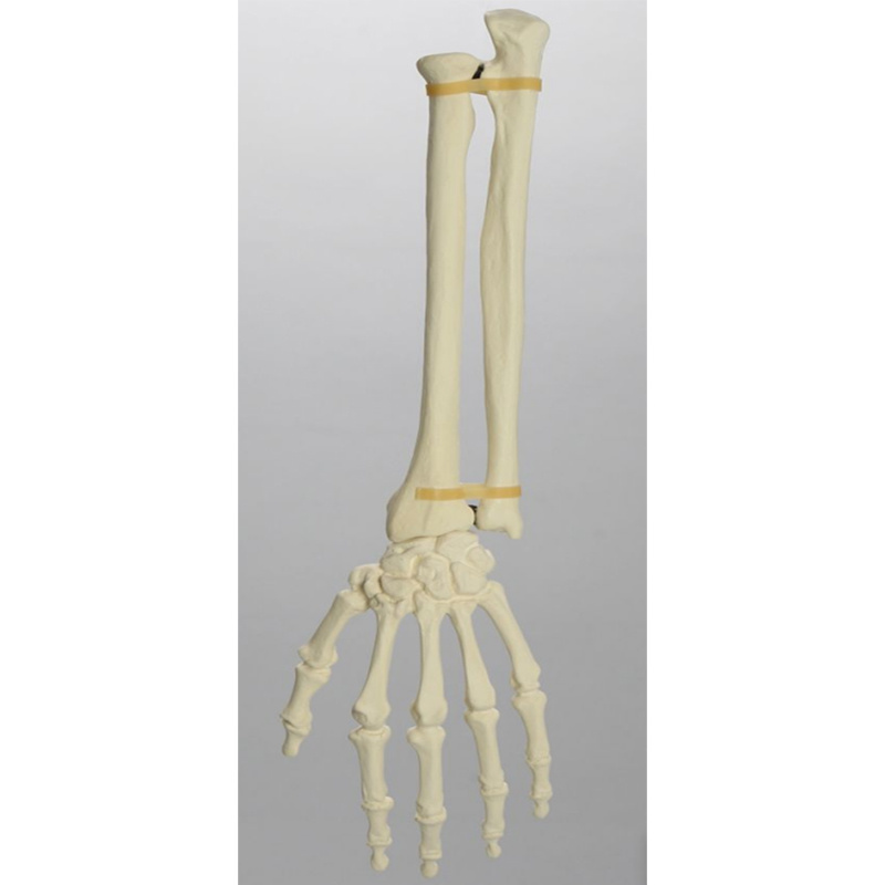 Radius, Ulna  and Hand Bone Practice Model
