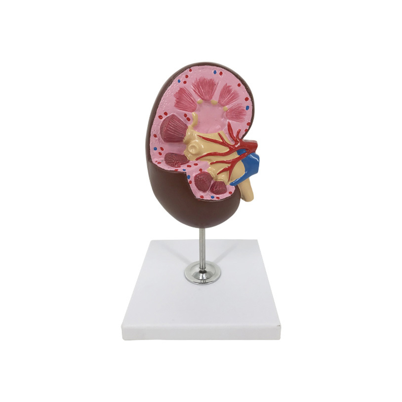 YA/U022D Kidney Model, 2X Life Size