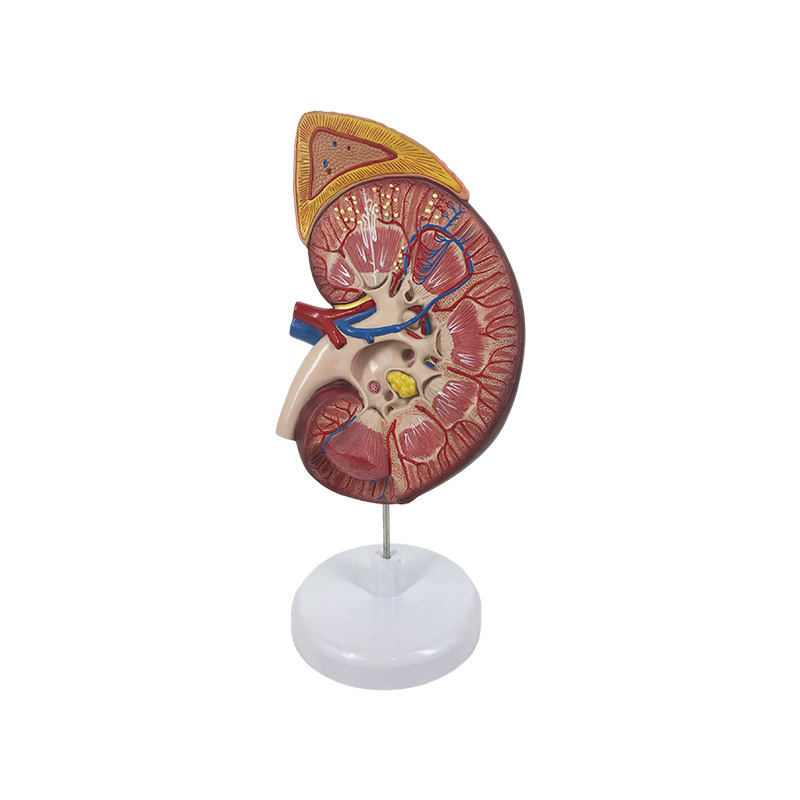 YA/U022A Kidney with Adrenal Gland, 3X life size