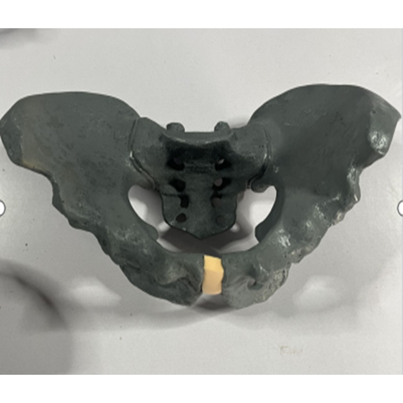 X-Ray Imaging of Pelvic Bone Model