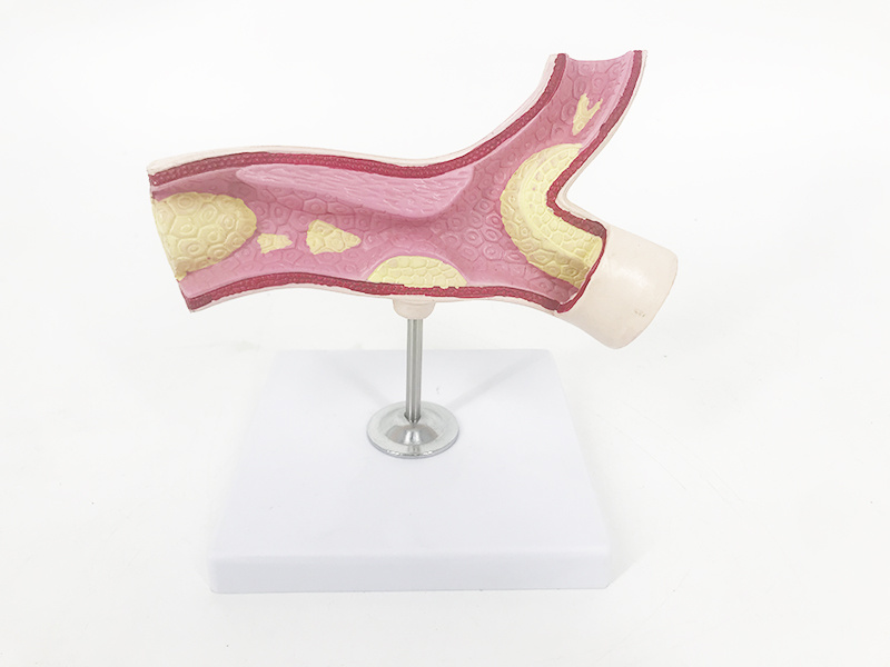 YA/C017 Artery Section Anatomy Model