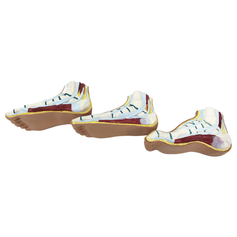 YA/L126 Set of 3 Feet - Flat Foot, Arched Foot and Normal Foot