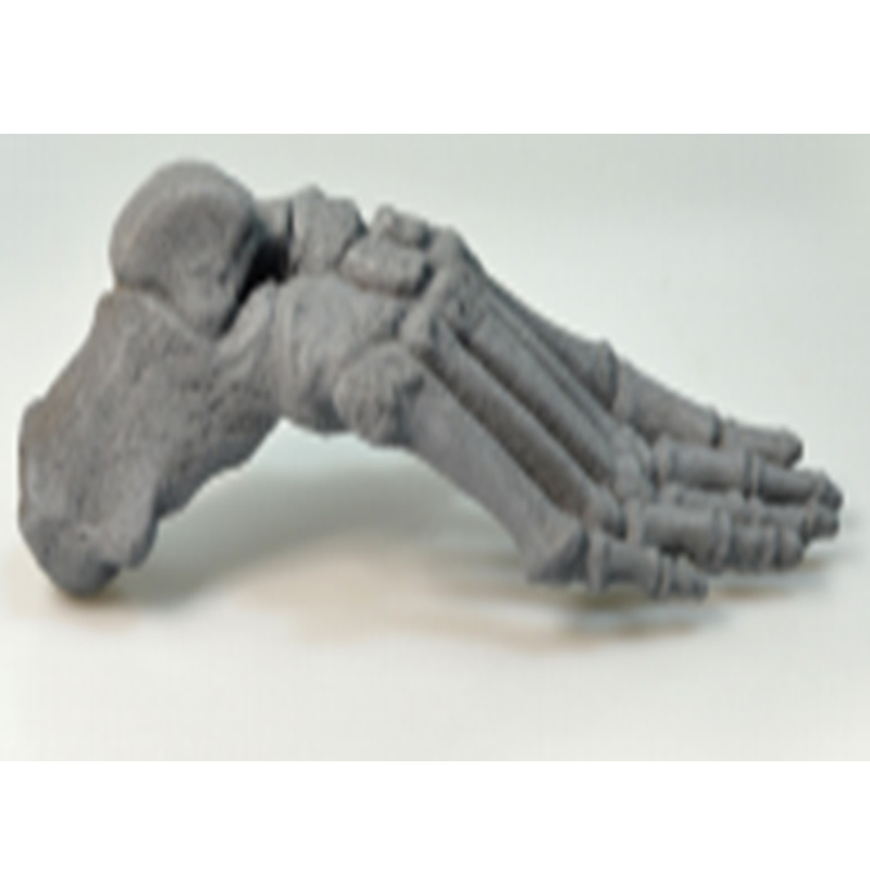 X-Ray or CT Imaging of Supinated Foot Bone Practice Model