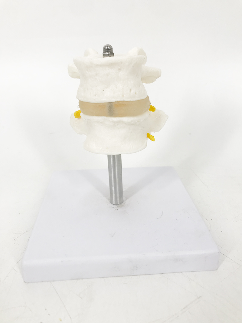 YA/L035 Vertebrae Model 2 pcs