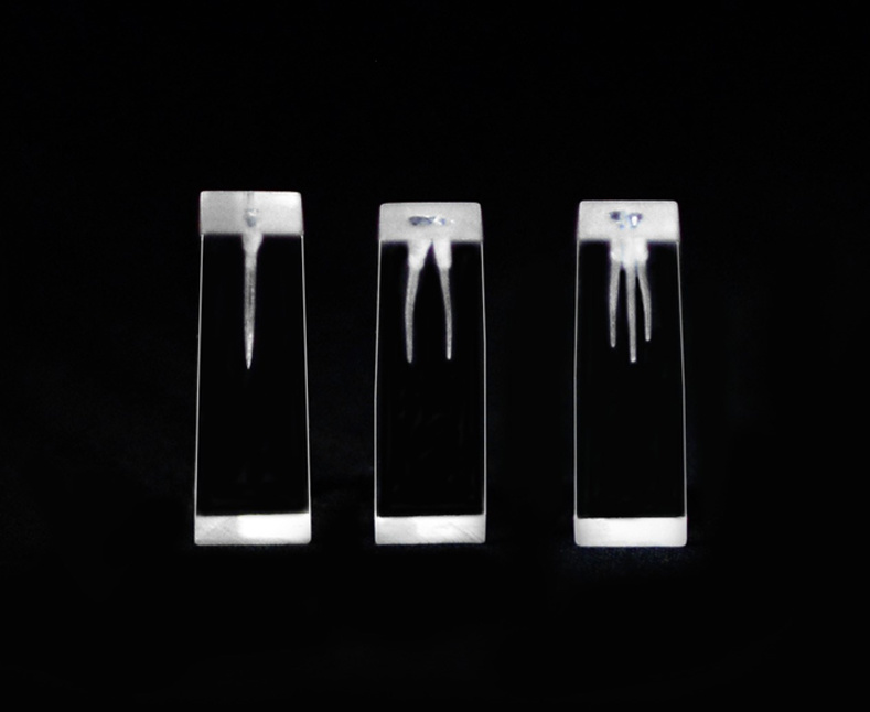 Widening of the Root Canal