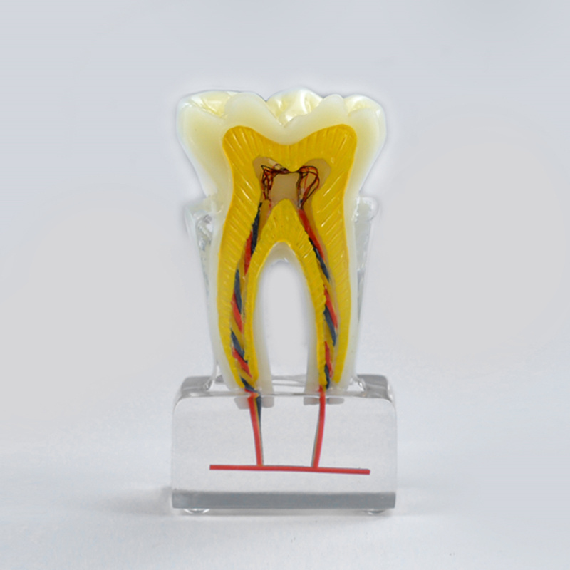 6X Dental Model with Dental Nerve