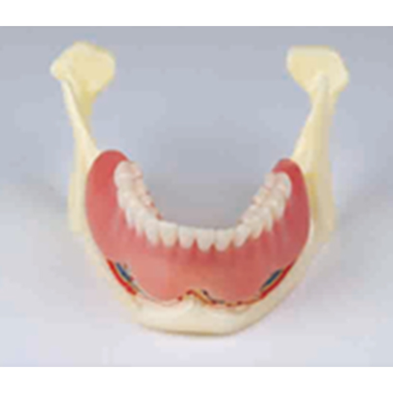 Dental Restoration Model