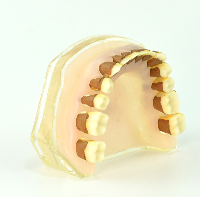 Periodontitis Model