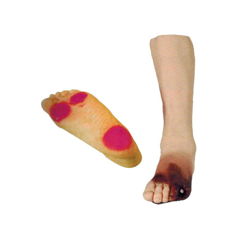 Diabetes Foot Model