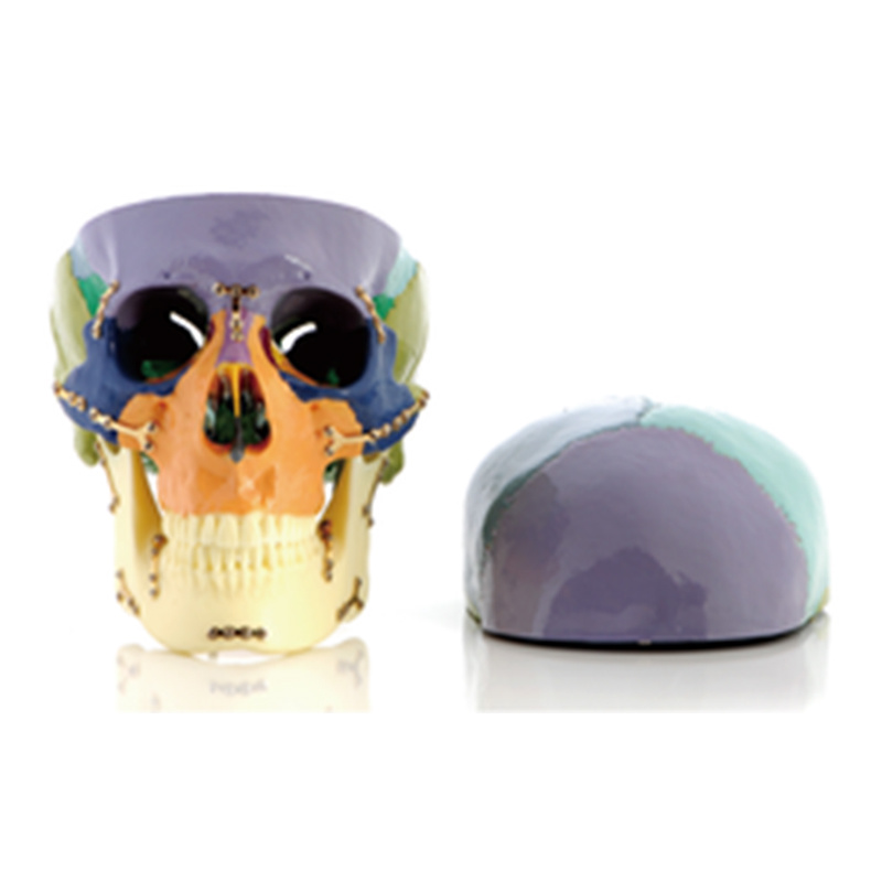 Skull Fracture Fixation Model