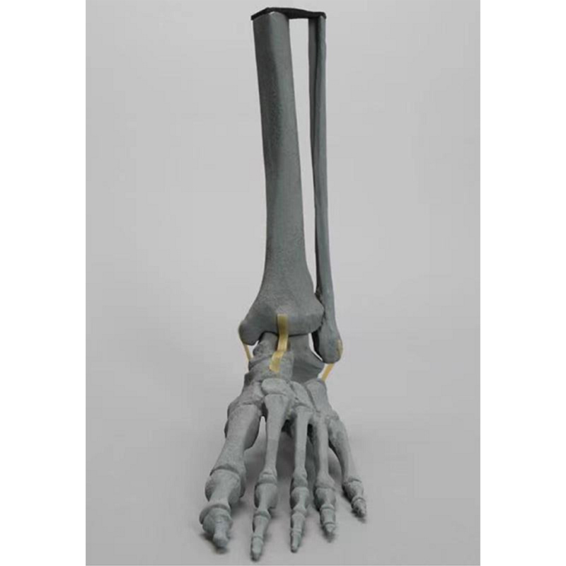 X-Ray Imaging of Tibia, Fibula and Foot Bone