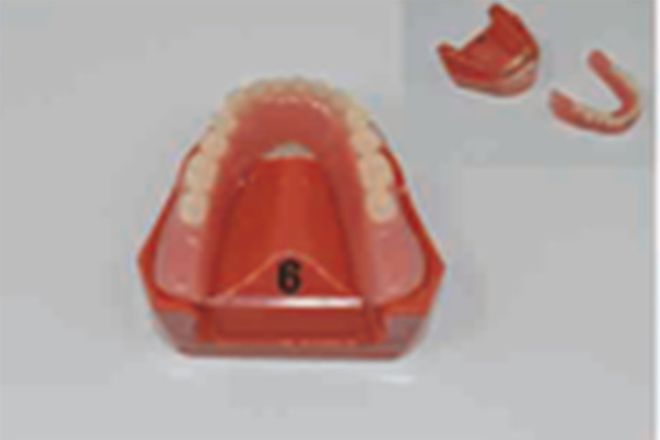 Dental Restoration Model
