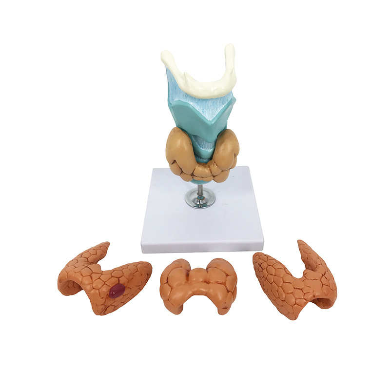 YA/R034 Thyroid Disease Model