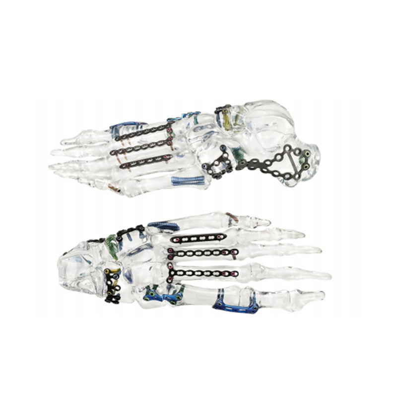 Crystal Foot Bone Model