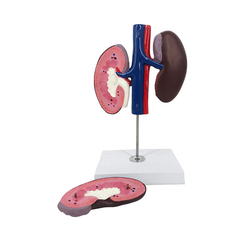 YA/B029-2 Pig Kidney Model