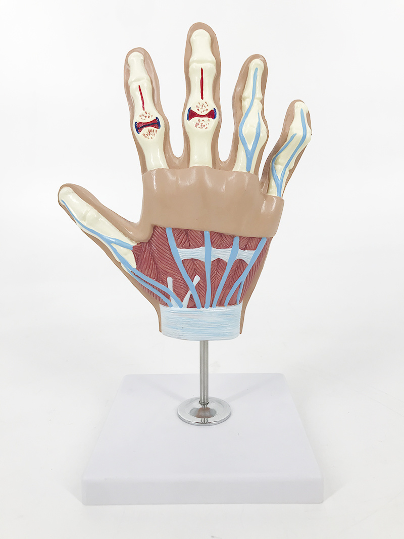 Arthritis model