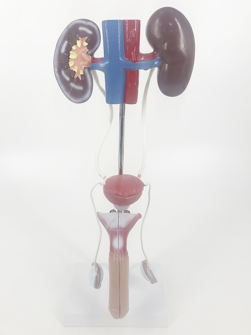 YA/U011 Men's urinary system model