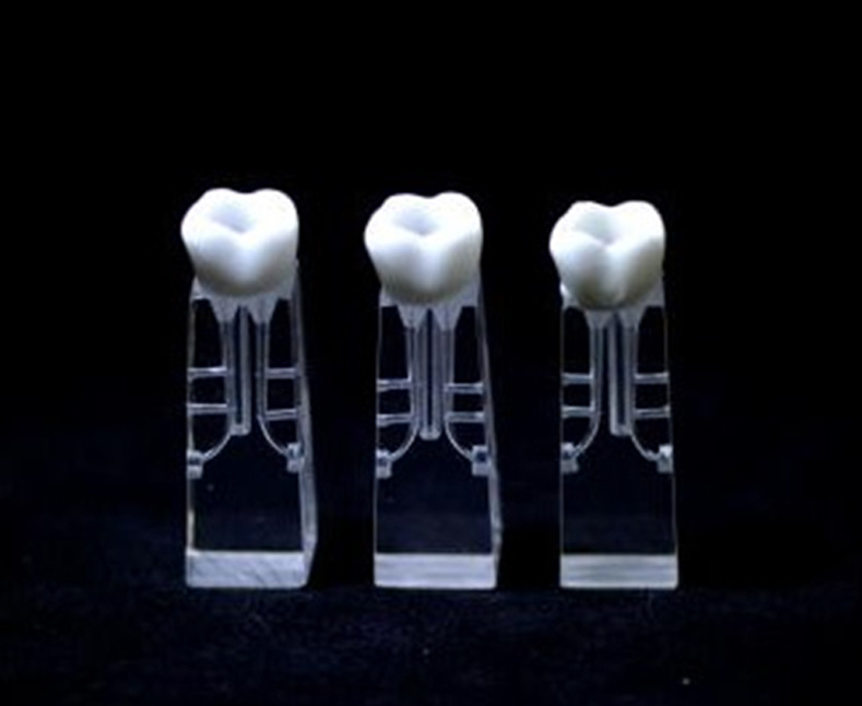 Bilateral Laterlal Root Canal