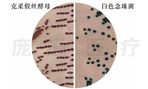 念珠菌显色琼脂培养基/B型(OCCA)