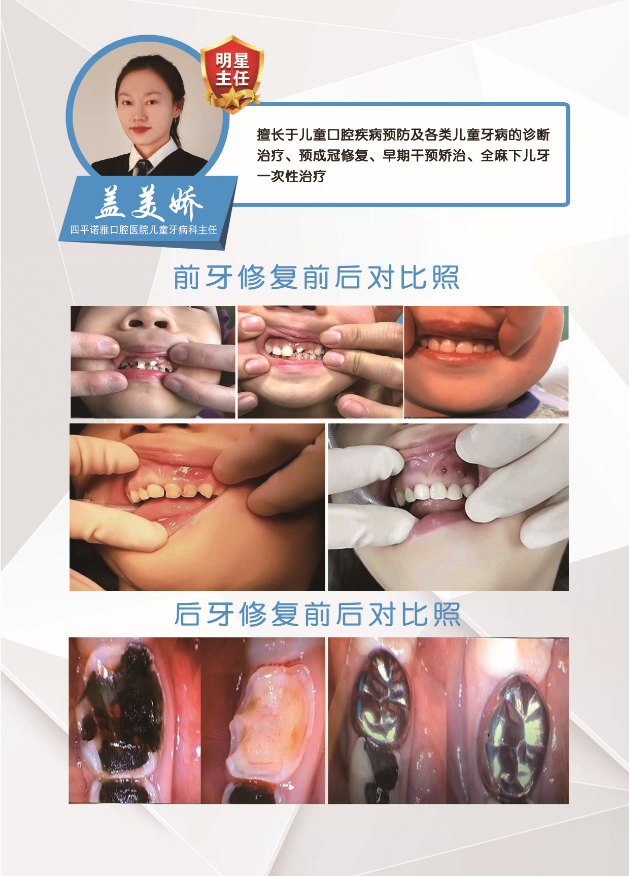兒童牙齒修復(fù)