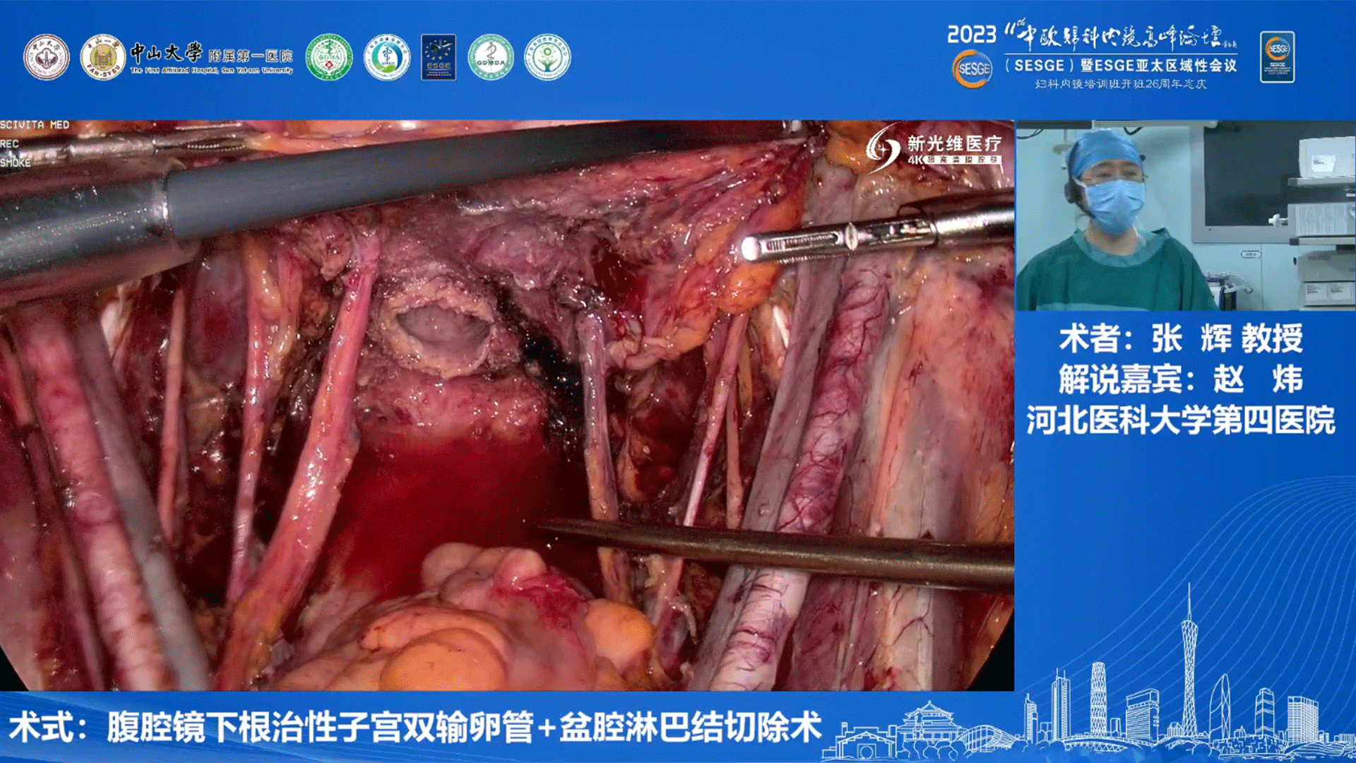 2-3 张辉.gif