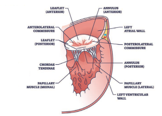 Management of Complex Valve Disease Patients