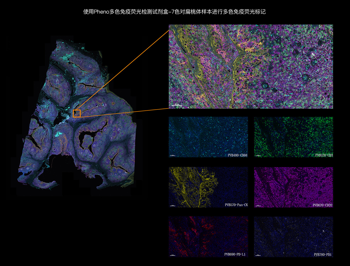 PhenoVision Bio