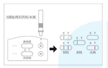 淋球菌/沙眼衣原体抗原联合检测试剂盒(胶体金法)