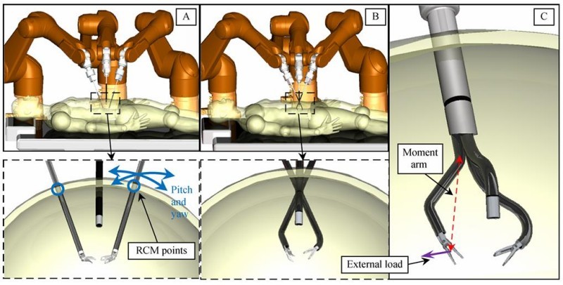 Unlocking Surgical Robot Precision: CNC Machining Cost Optimization with DeepSeek AI & Yixin Precision