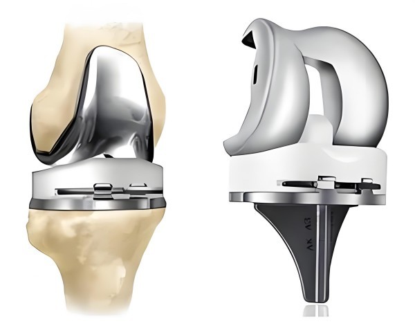 CNC machining for implantable medical devices