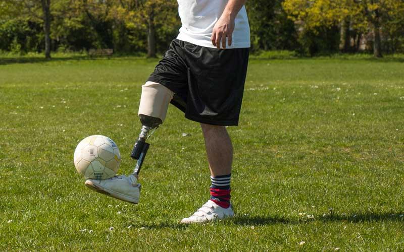 Prosthetic Legs