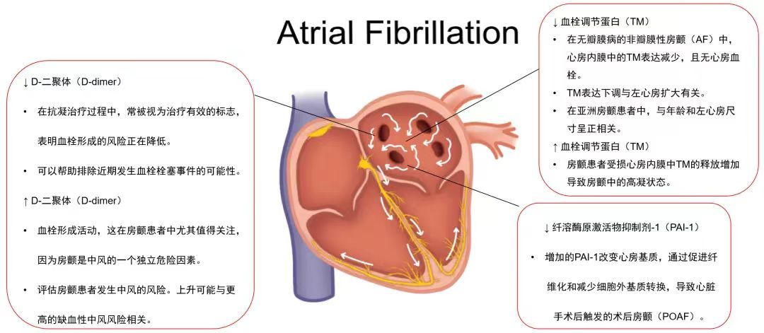 血栓標志物：心血管急危重癥的“偵察兵”