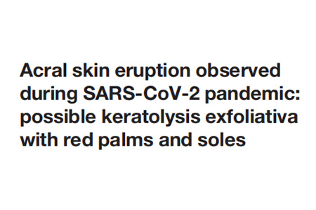 SARS-CoV-2大流行期间观察到的肢端皮疹：掌心和脚底发红可能为剥脱性角质松解症