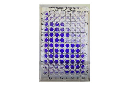 新冠mRNA 疫苗BNT162b2 觸發(fā)一致的交叉體液和細(xì)胞反應(yīng)