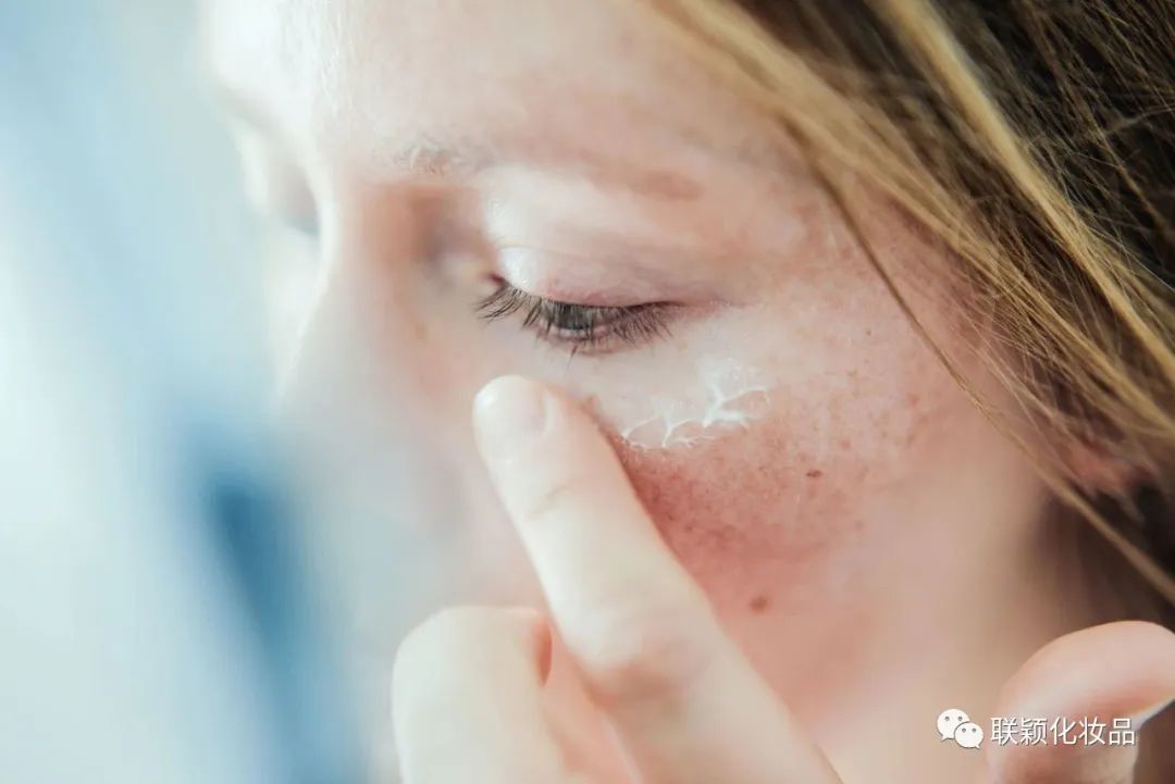 Skin care exploration | What is skin inflammation? How to effectively anti-inflammatory?