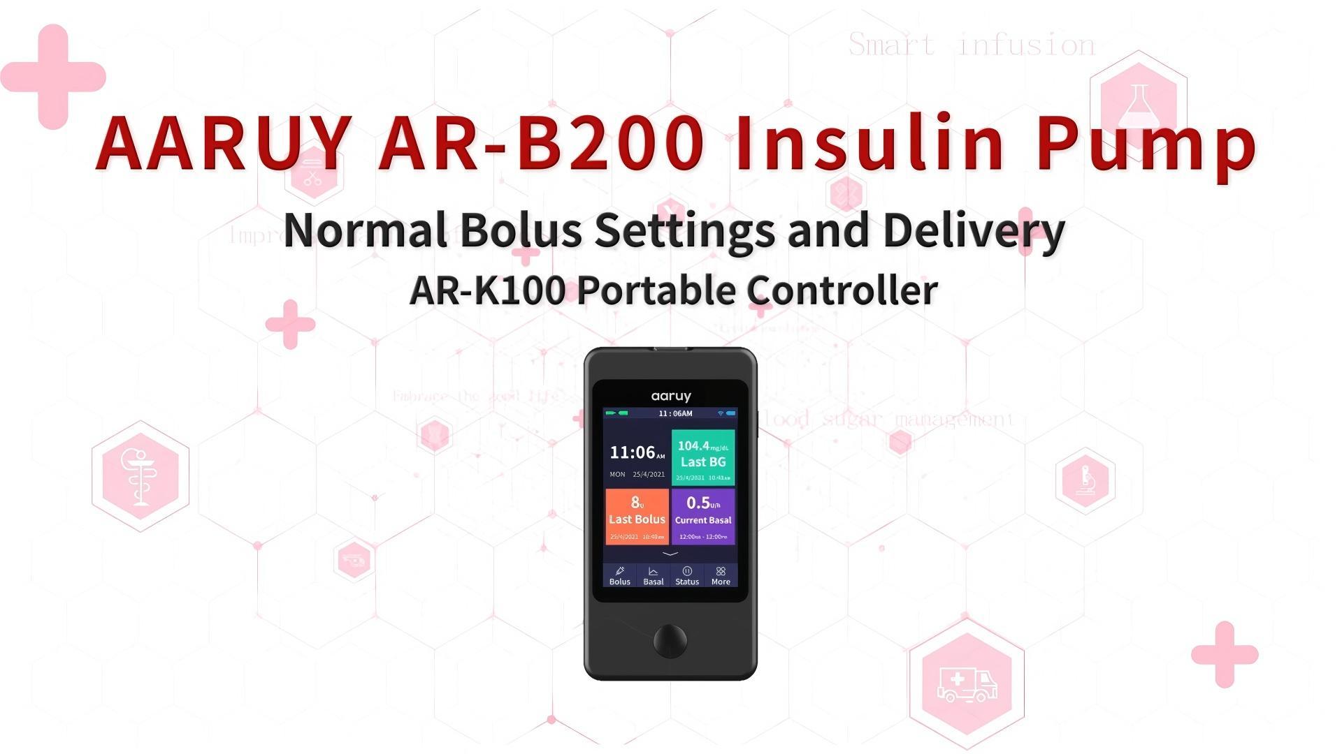 4. Normal Bolus Settings and Delivery__AR-K100 Portable Controller 4. Normal Bolus Settings and Delivery__AR-K100 Portable Controller