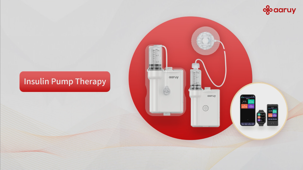 0. Insulin Pump Therapy 0. Insulin Pump Therapy