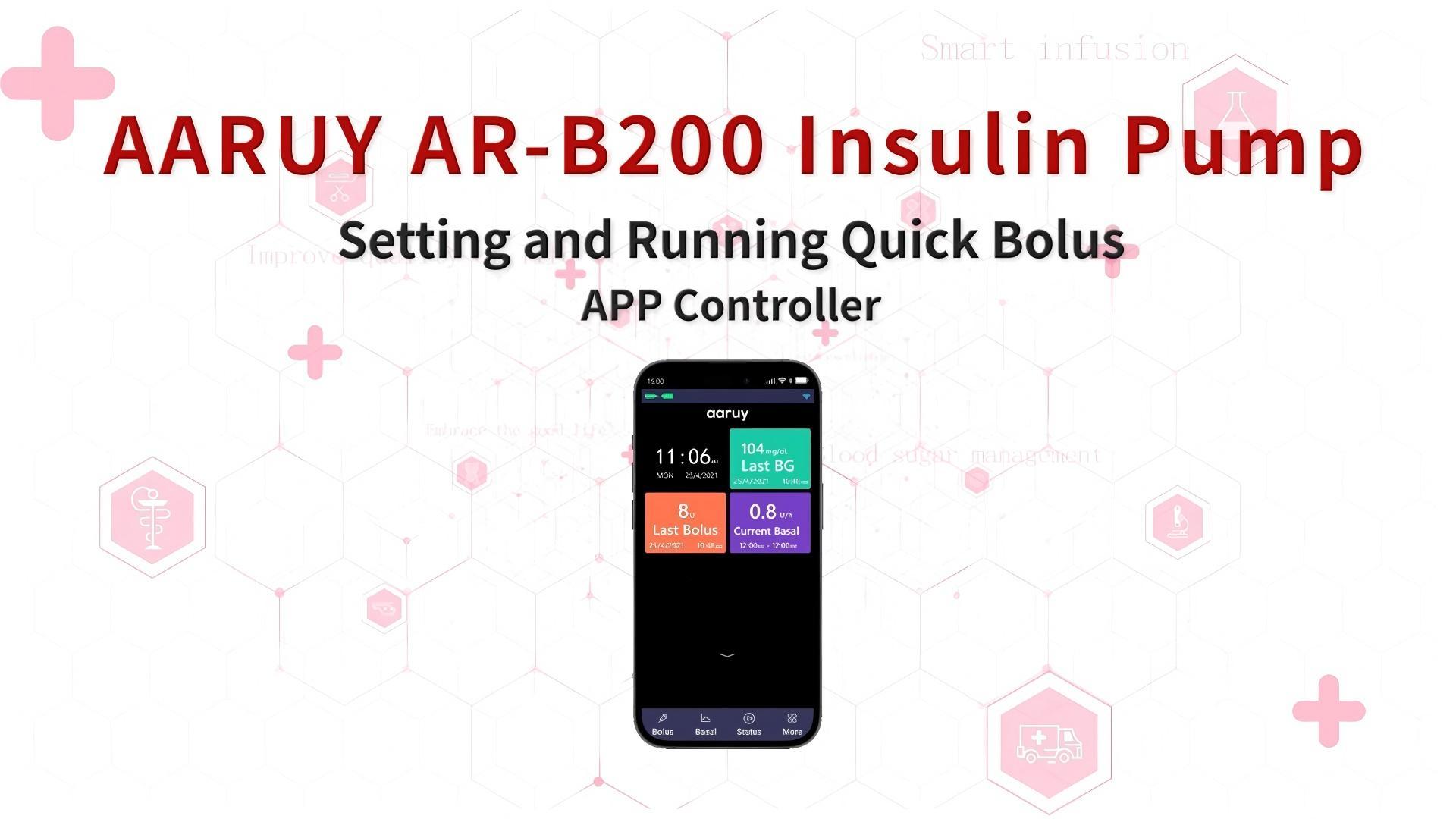 12. Setting and Running Quick Bolus__APP Controller 12. Setting and Running Quick Bolus__APP Controller